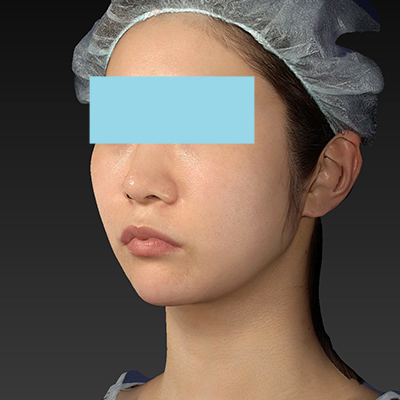 After image