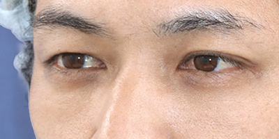After image