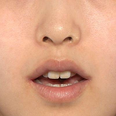 After image