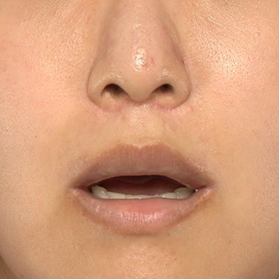 After image