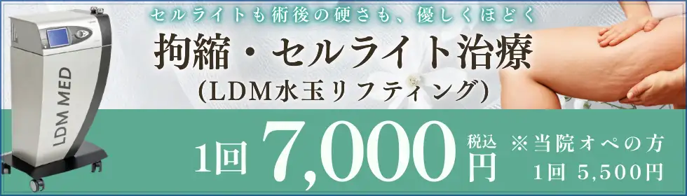 拘縮・セルライト治療(LDM水玉リフティング)'バナーイメージ