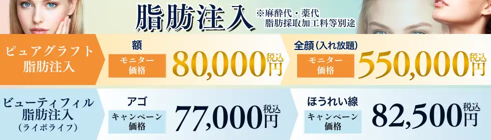 脂肪注入'バナーイメージ
