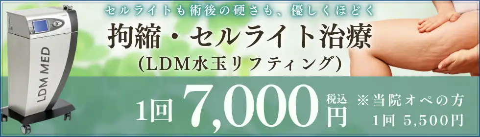 拘縮・セルライト治療(LDM水玉リフティング)'バナーイメージ