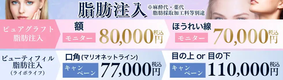 脂肪注入'バナーイメージ
