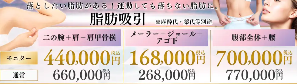 脂肪吸引'バナーイメージ