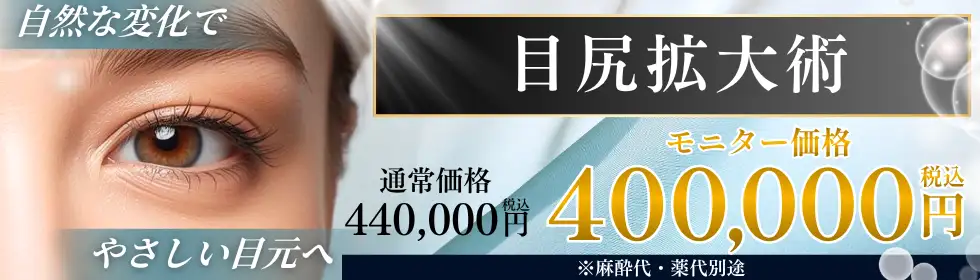 目尻拡大術'バナーイメージ
