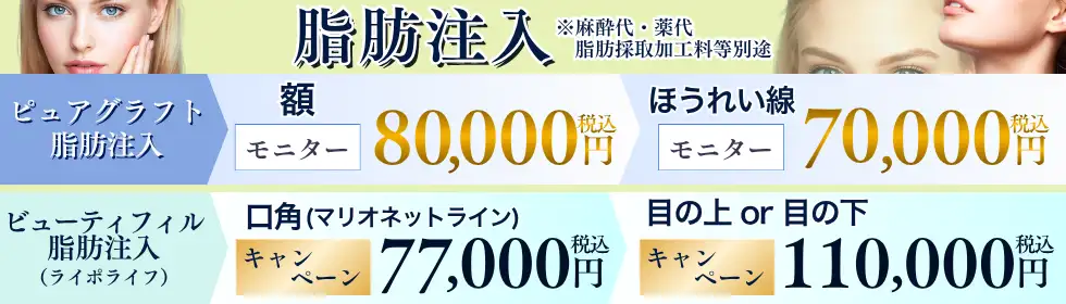 脂肪注入'バナーイメージ