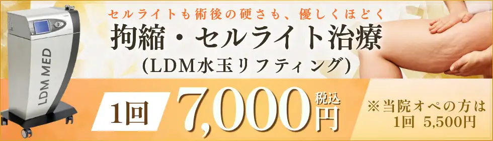 拘縮・セルライト治療(LDM水玉リフティング)'バナーイメージ