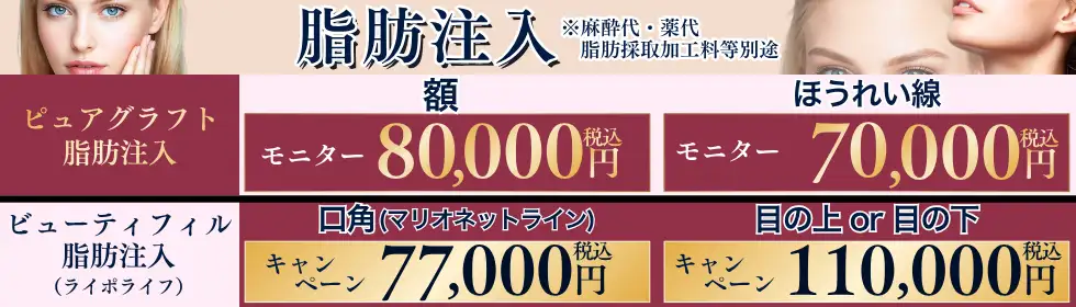 脂肪注入'バナーイメージ