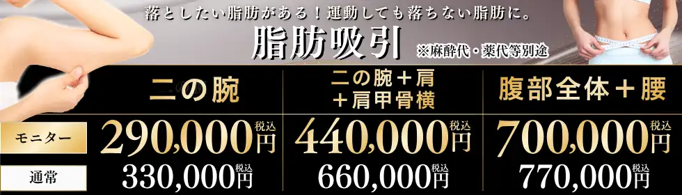 脂肪吸引'バナーイメージ