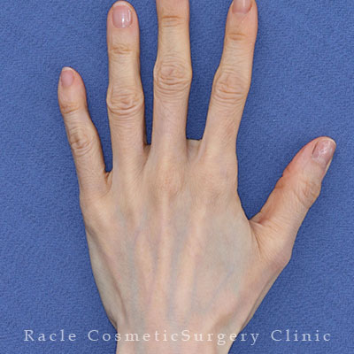 治療後12ヶ月目