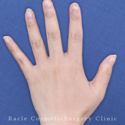 治療後12ヶ月目