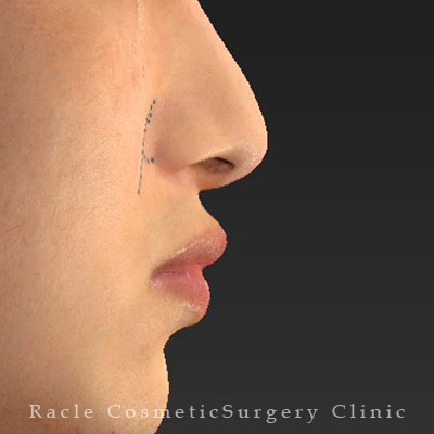 手術前デザイン