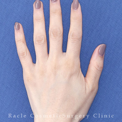 治療後12ヶ月目