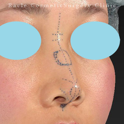 手術前デザイン