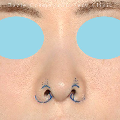 手術前デザイン