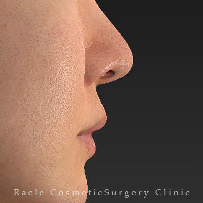 手術前デザイン