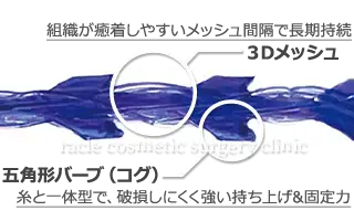 アルテミスリフトの糸イラスト