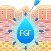 FGF注入療法イメージ