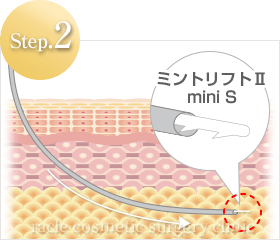 糸の挿入方法 Step.2