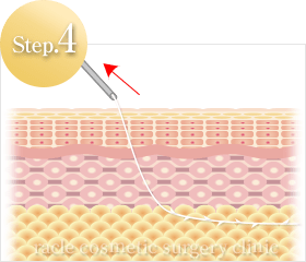 糸の挿入方法 Step.4