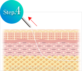 糸の挿入方法 Step.4