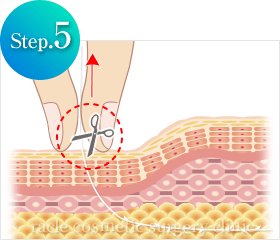糸の挿入方法 Step.5