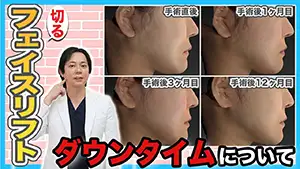 フェイスリフト Youtube動画02　サムネイル