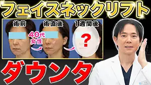 フェイスリフト Youtube動画02　サムネイル