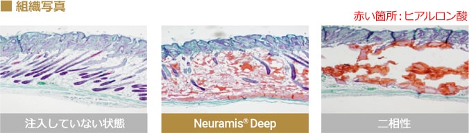 NeuramisDeepと二相性の皮膚統合性比較写真