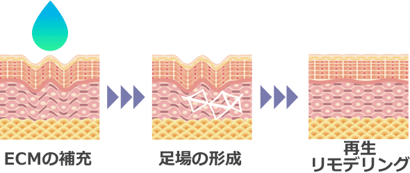 ECMの補充による肌のリモデリング経過イメージイラスト