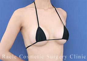 Motivaエルゴノミクスの症例写真11 After