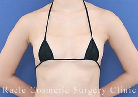 Motivaエルゴノミクスの症例写真12 Before