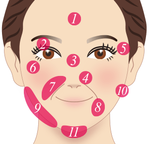 顔　治療部位イメージ