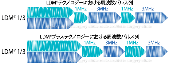 LDMの周波振動の違いによるパルス列の図
