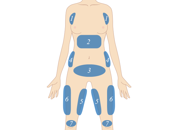 BODY(正面)　治療部位イメージ