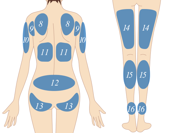 BODY(背中)　治療部位イメージ