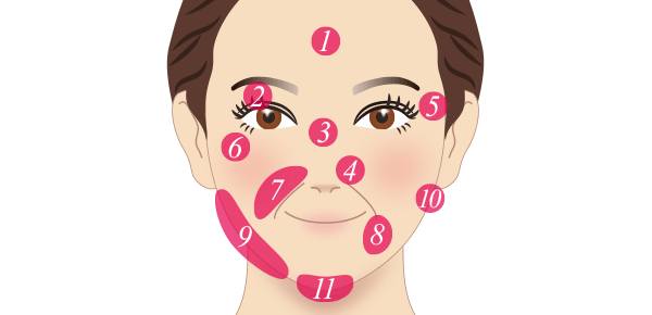 顔　治療部位イメージ
