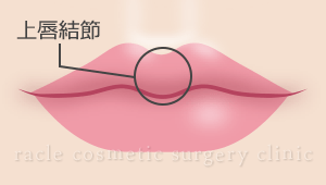 上唇結節　部位説明イラスト