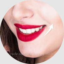 女優な笑顔 イメージ