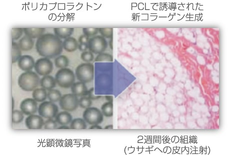 PCLの新コラーゲン生成　組織の顕微鏡写真(ウサギ）