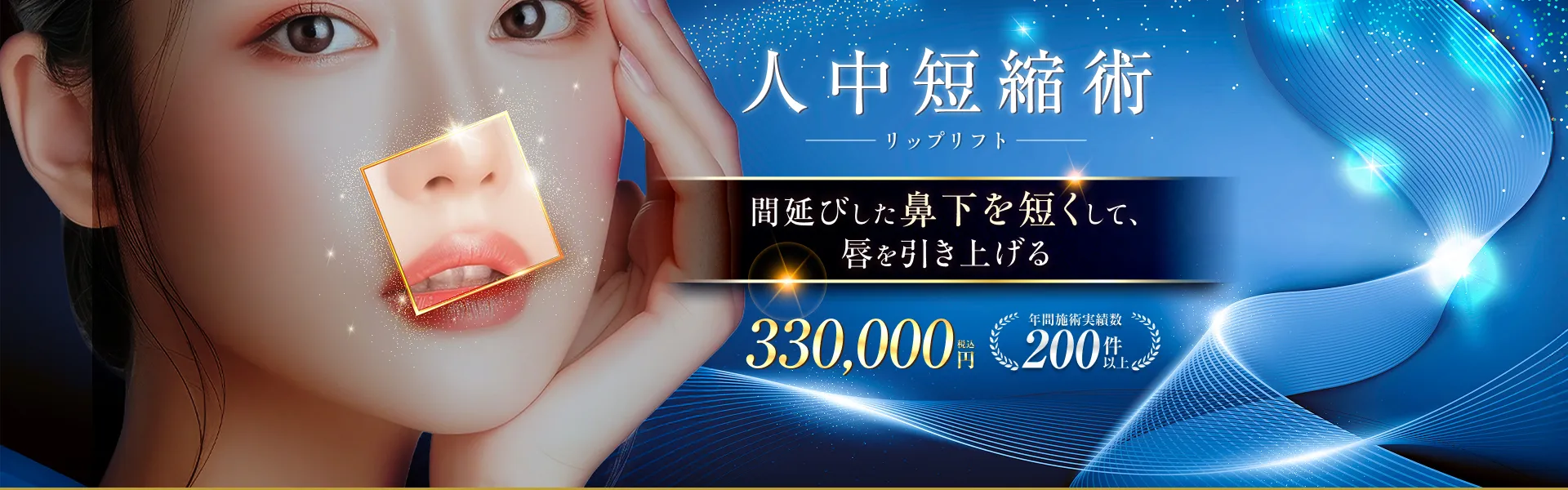 間延びした鼻下を短くして、唇を引き上げる 330,000円 年間施術実績数200件以上
