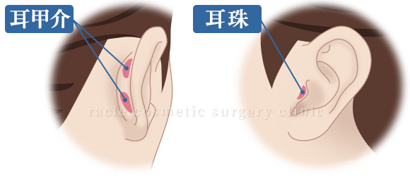 猫手術　耳介軟骨イメージ