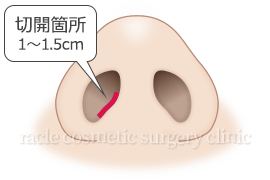 猫手術　鼻の切開箇所イメージ