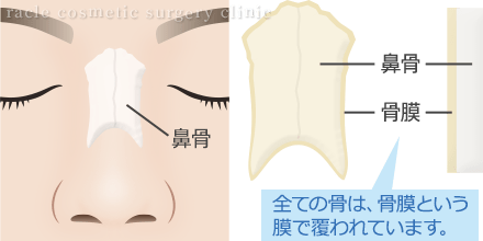 鼻骨と骨膜のイメージイラスト