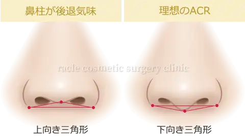 ACRイメージ