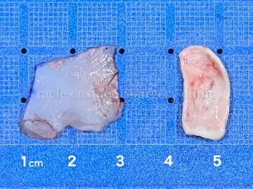 実際に採取した鼻中隔軟骨と耳介軟骨の写真