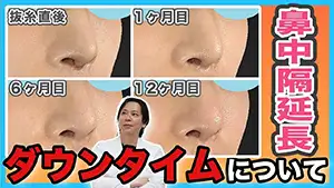鼻中隔延長 Youtube動画01　サムネイル