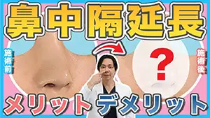 鼻中隔延長 Youtube動画02　サムネイル