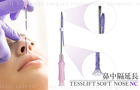 鼻先の鼻中隔延長の施術イメージ